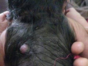 Child born with hair and wart on its back in northern India – Newslions Media Network Child born with hair and wart on its back in northern India – Newslions Media Network