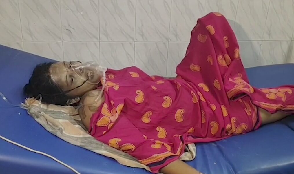 Woman falls victim to acid attack in southern India, probe on